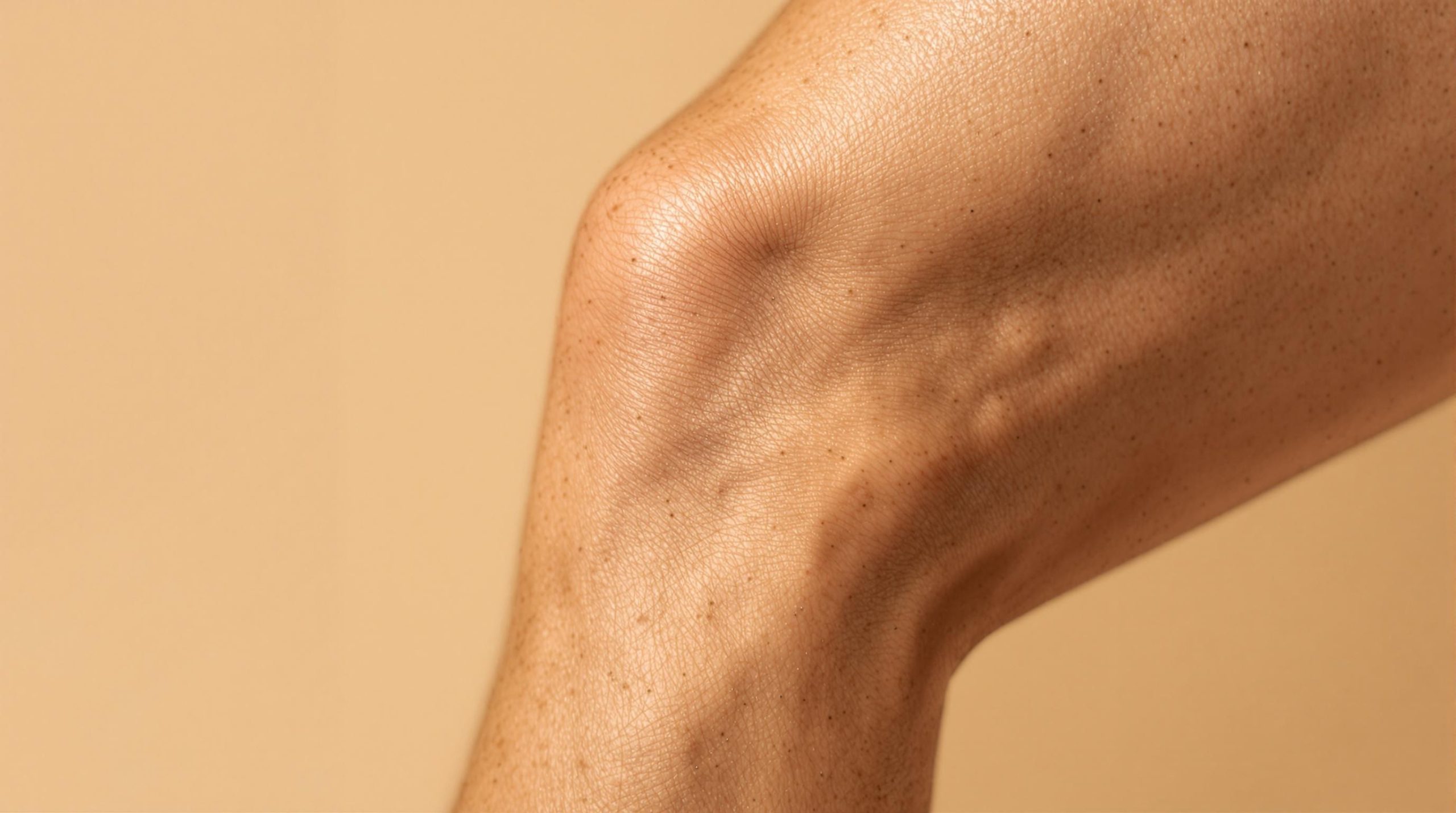 Vergetures sur les cuisses chez les hommes : causes, traitements et prévention - Fashion Beaute Naturelle